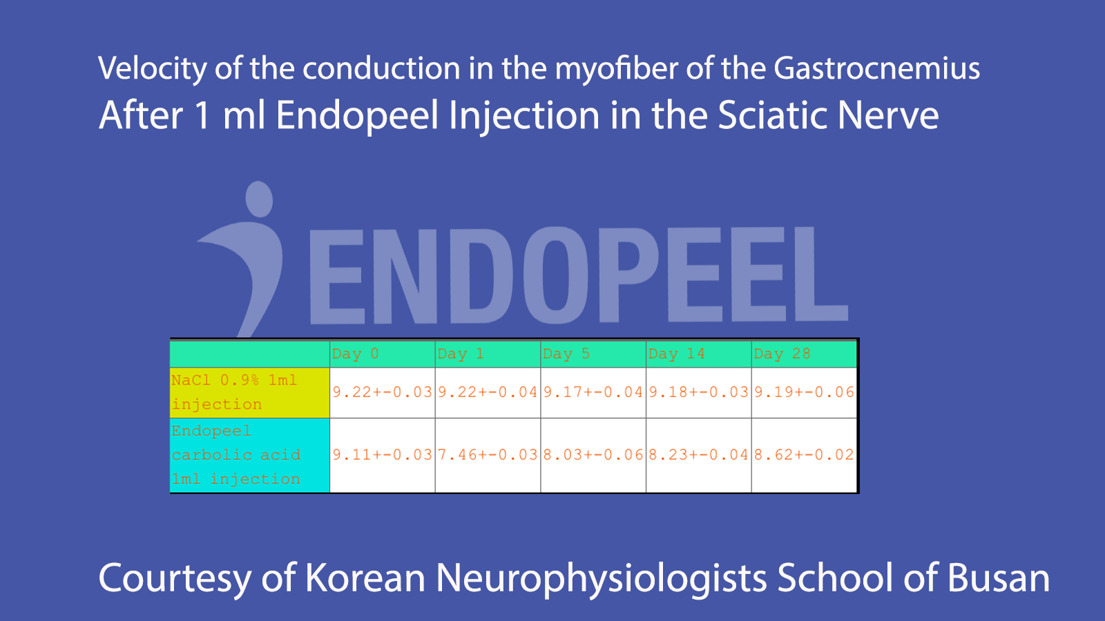 Velocity of the Conduction in the Nerve after Endopeel